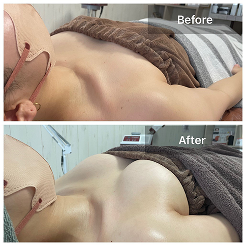 脱毛と一緒に整体で身体をほぐしませんか?のイメージ